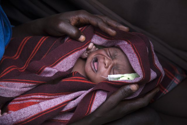 ondervoeding oost afrika