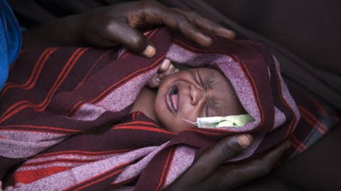 ondervoeding oost afrika